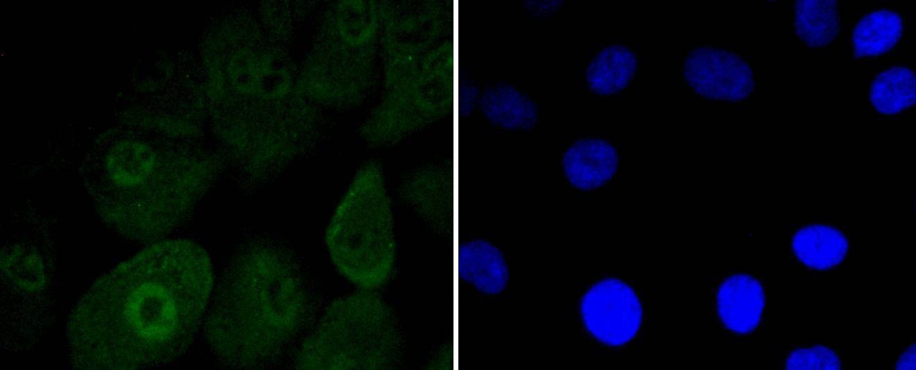 Anti-Musashi 1 Antibody (3I437)