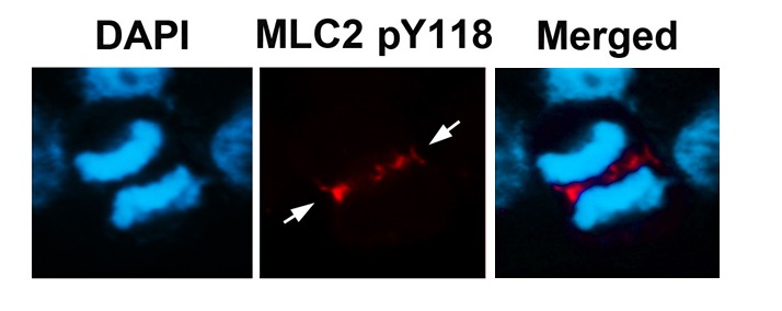 Anti-Phospho-MLC2 (Tyr118) Polyclonal Antibody