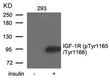Anti-Phospho-IGF1R/CD221 (Tyr1165, 1166) Polyclonal Antibody