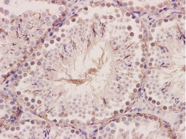 Anti-Integrin beta 3 Antibody (4P677)