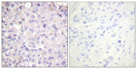 Anti-Phospho-IKBKB (Tyr188) Polyclonal Antibody