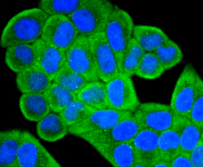 Anti-IGF2/IGF-II Antibody (5T527)