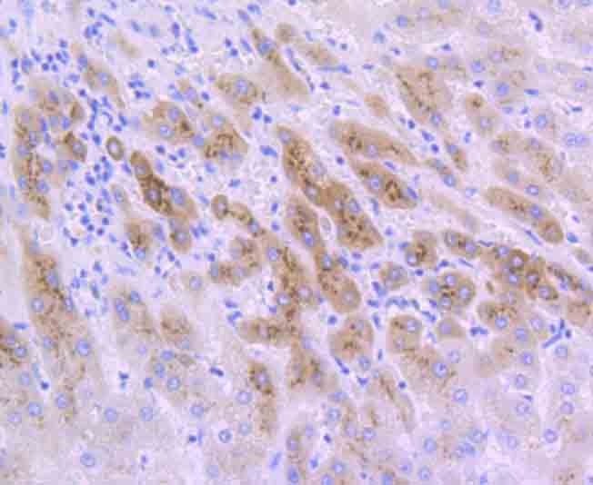Anti-IGFBP2 Antibody (2T360)