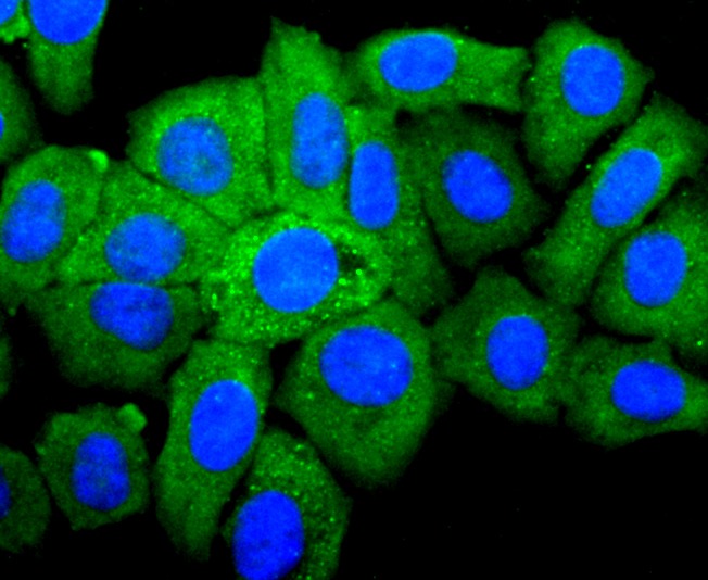 Anti-IGF2/IGF-II Antibody (5T527)