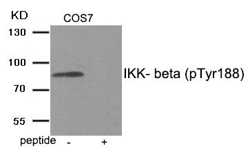 Anti-Phospho-IKBKB (Tyr188) Polyclonal Antibody