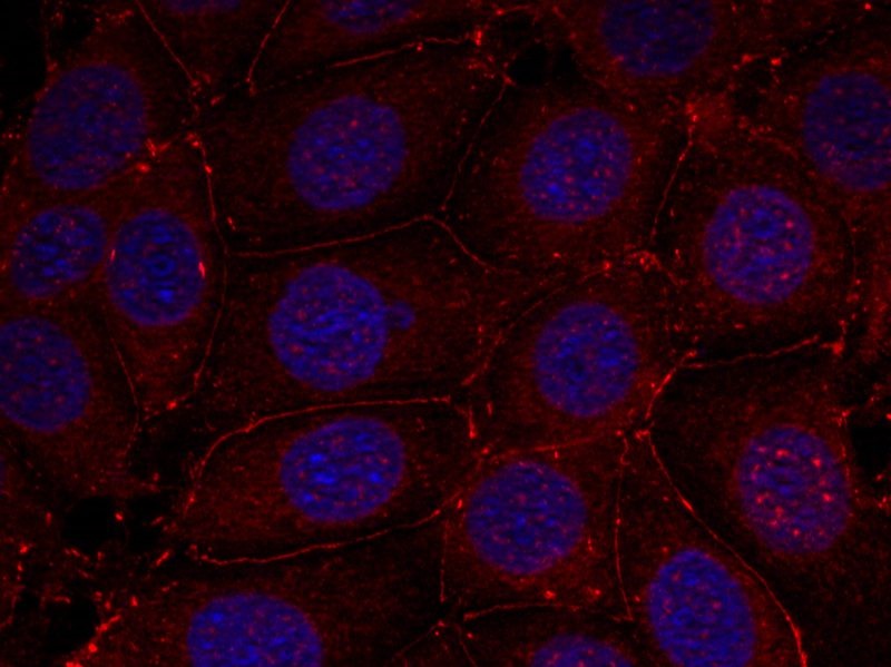 Anti-Phospho-IGF1R/CD221 (Tyr1161) Polyclonal Antibody 2
