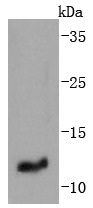 Anti-IGF2/IGF-II Antibody (5T527)