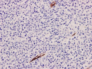 Anti-Integrin beta 3 Antibody (4P677)