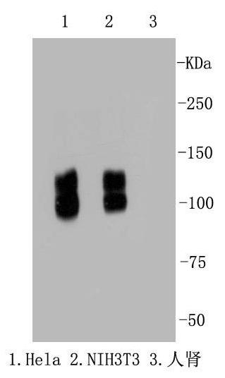 Anti-ITGB1 Antibody (1I859)