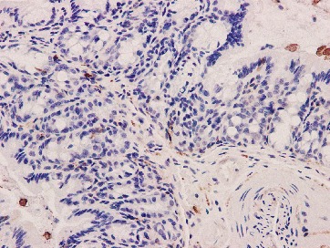 Anti-Integrin beta 3 Antibody (4P677)