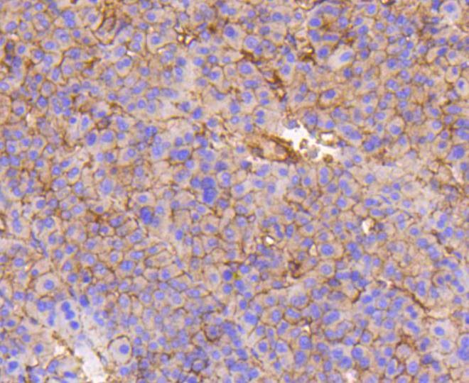 Anti-ITGB1 Antibody (1I859)