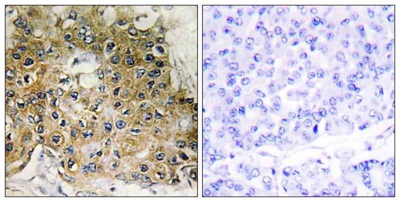 Anti-Phospho-ITGB1 (Thr789) Polyclonal Antibody