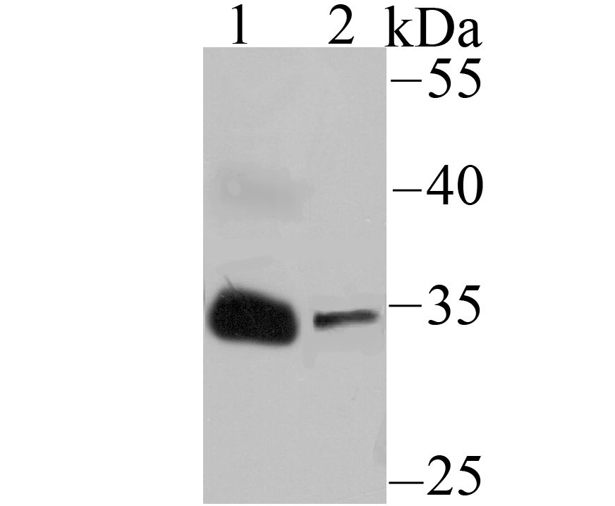 Anti-IGFBP2 Antibody (2T360)