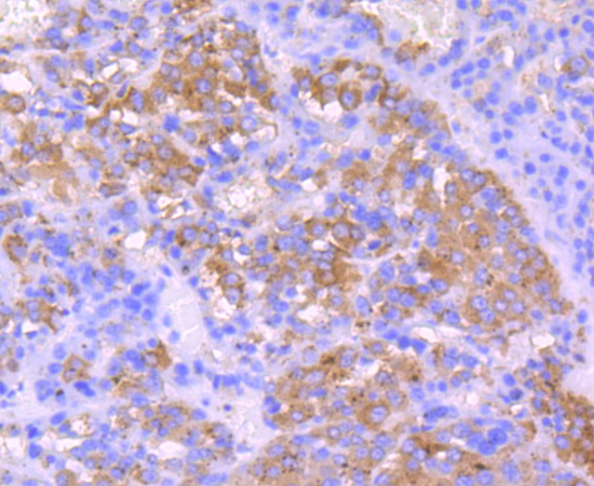 Anti-IGF2/IGF-II Antibody (5T527)
