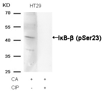 Anti-Phospho-IkappaB- beta (Ser23) Polyclonal Antibody
