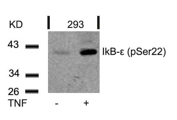 Anti-Phospho-IkB-e (Ser22) Polyclonal Antibody