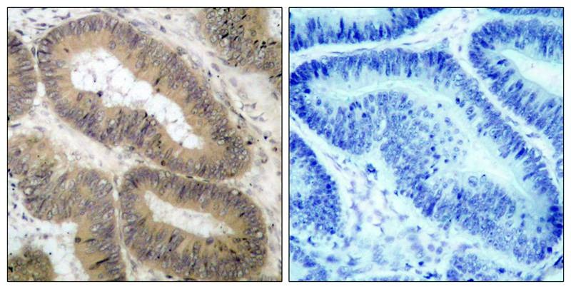 Anti-Phospho-IKBKA (Thr23) Polyclonal Antibody