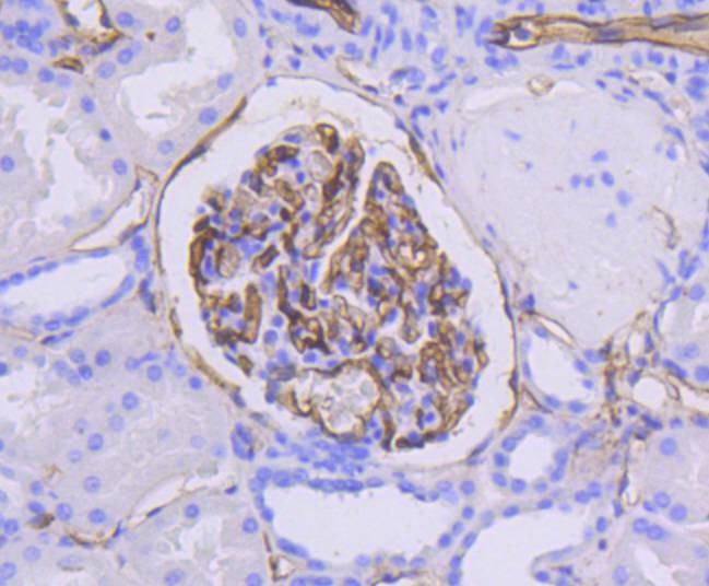 Anti-ICAM-1/CD54 Antibody (2M737)