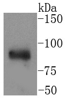 Anti-IKBKA Antibody (4P589)