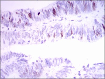 Anti-INCENP Antibody (3Z349)