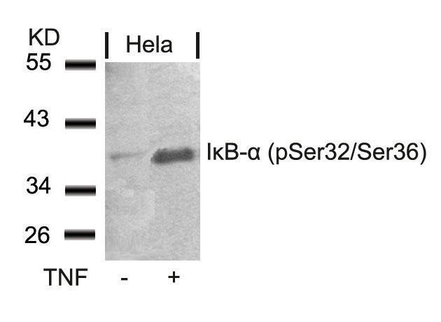 Anti-Phospho-NFKBIA (Ser32, 36) Polyclonal Antibody