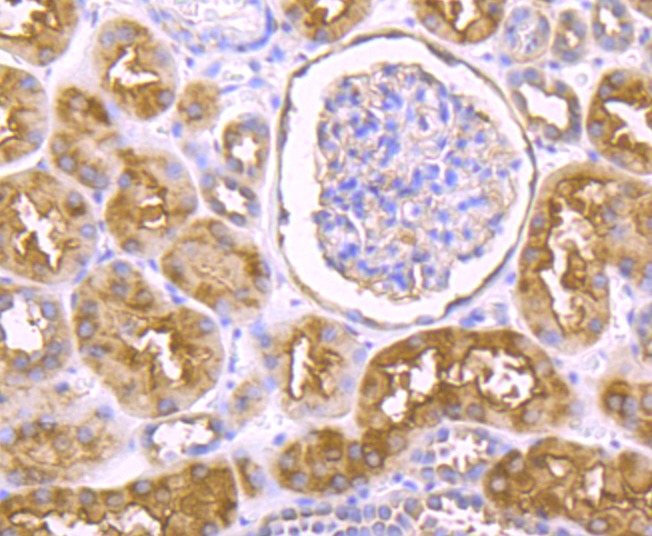 Anti-IKBKE Antibody (6N528)