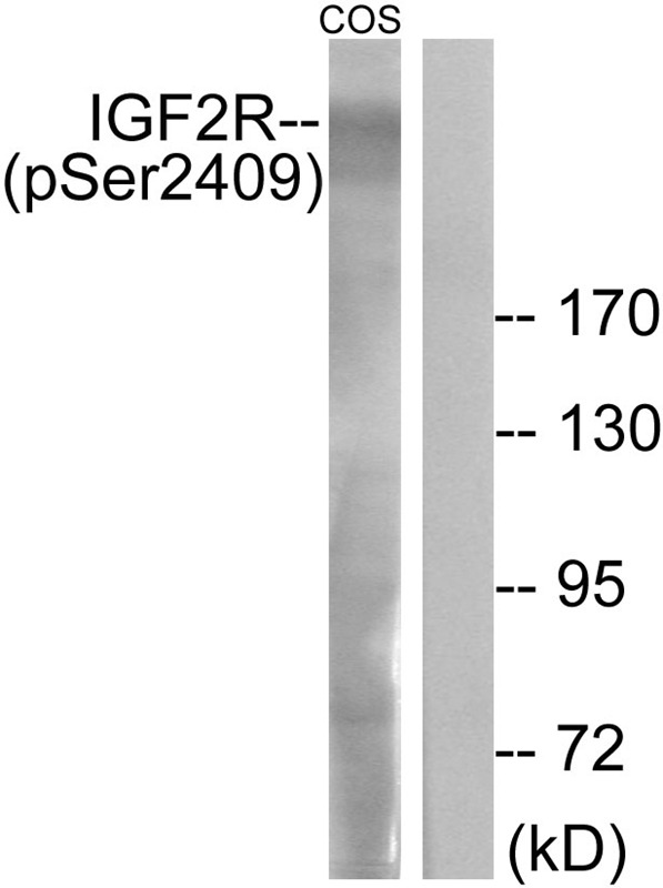 Anti-Phospho-IGF2R (Ser2409) Polyclonal Antibody 2