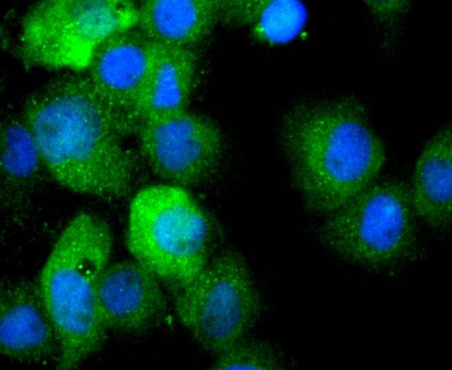 Anti-IL-1 beta/IL-1F2 Antibody (7U755)