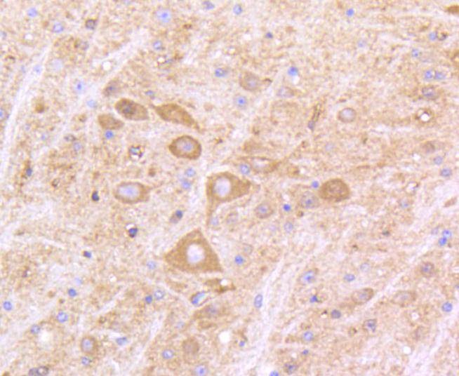 Anti-IFNAR1 Antibody (1R657)