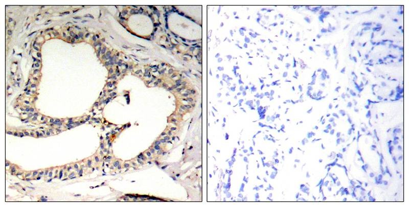 Anti-Phospho-IkB-e (Ser22) Polyclonal Antibody