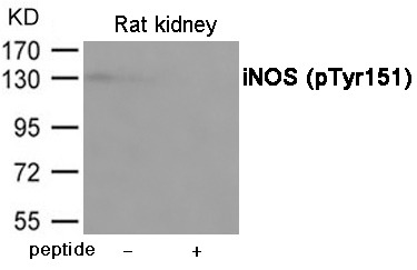 Anti-Phospho-iNOS (Tyr151) Polyclonal Antibody 2