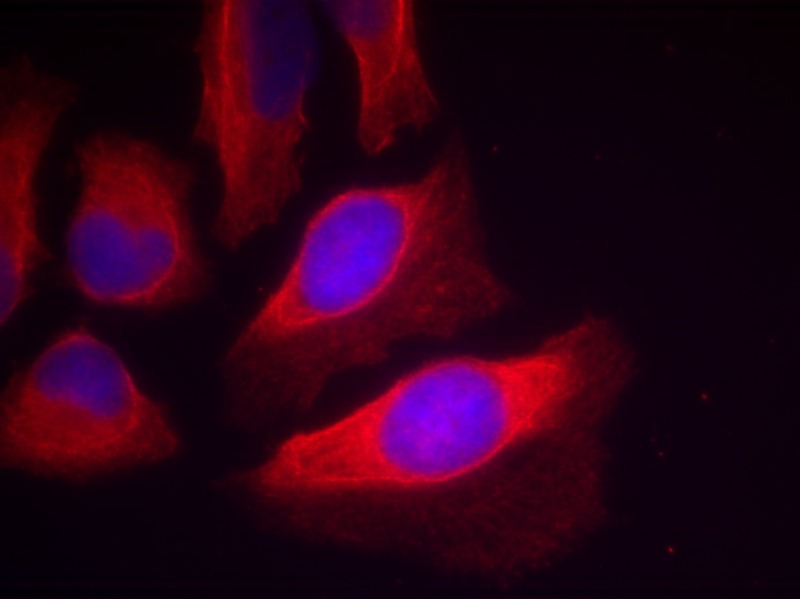 Anti-Phospho-IKBKB (Tyr199) Polyclonal Antibody 2