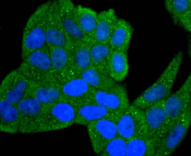 Anti-IL-1 beta/IL-1F2 Antibody (7U755)