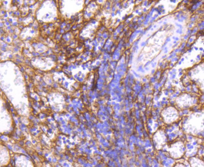 Anti-ICAM-1/CD54 Antibody (2M737)