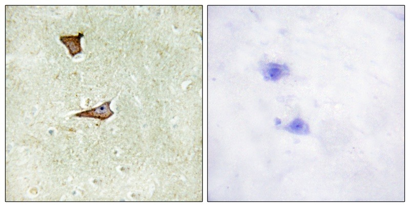 Anti-Phospho-IGF2R (Ser2409) Polyclonal Antibody 2