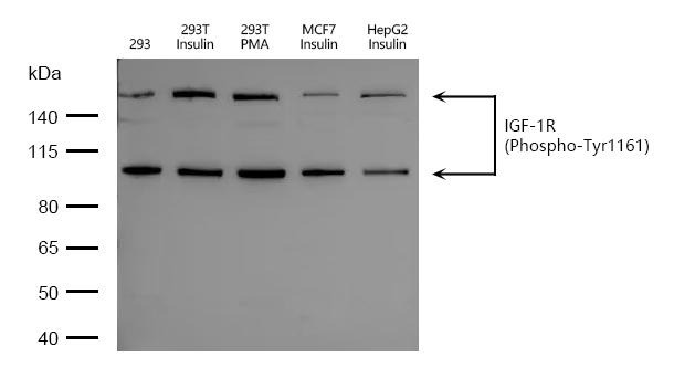 Anti-Phospho-IGF1R/CD221 (Tyr1161) Polyclonal Antibody 2
