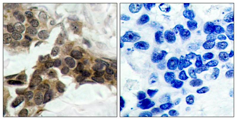 Anti-Phospho-NFKBIA (Ser32, 36) Polyclonal Antibody