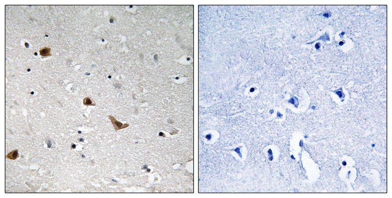 Anti-Phospho-IKK- gamma (Ser376) Polyclonal Antibody