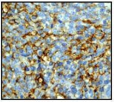 Anti-ICAM-1/CD54 Antibody (7M396)