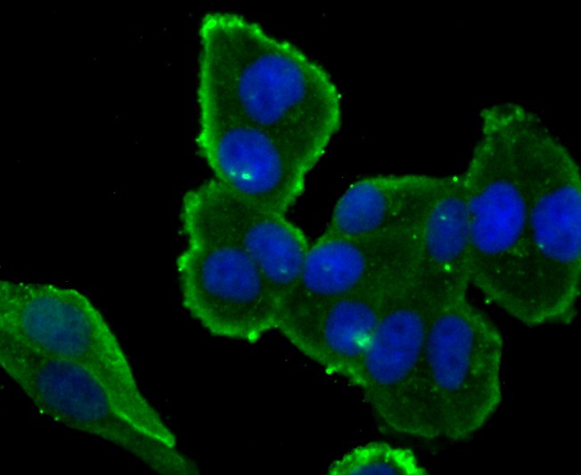 Anti-IKBKE Antibody (6N528)