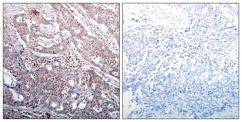 Anti-Phospho-IkappaB- beta (Ser23) Polyclonal Antibody