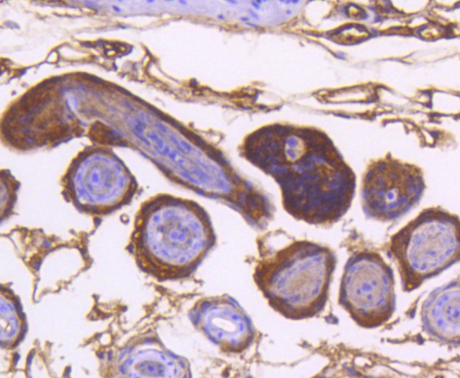 Anti-IKBKA Antibody (4P589)