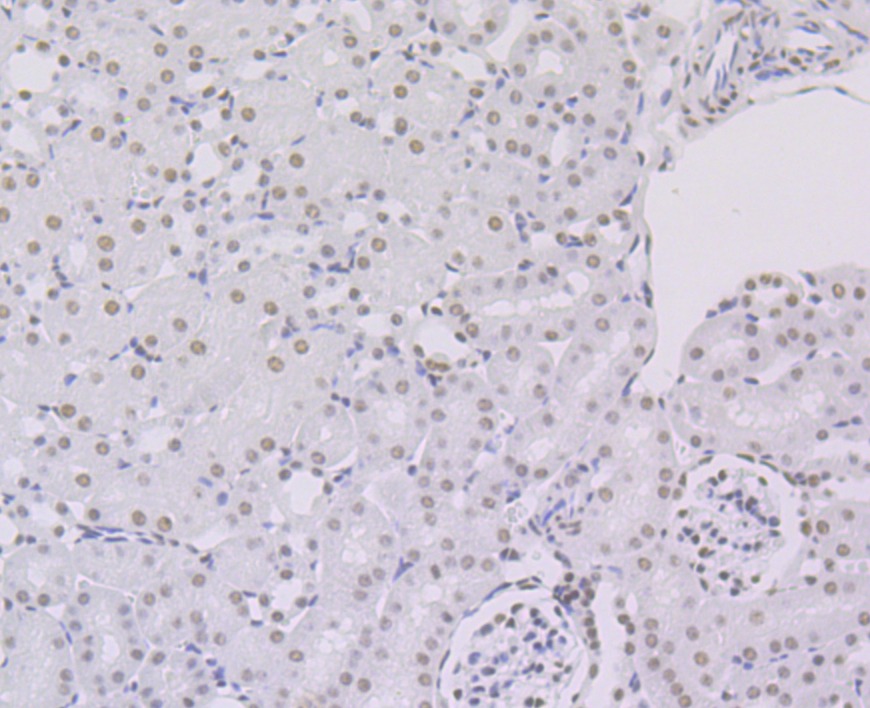 Anti-ILF3 Antibody (8T791)