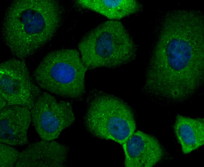 Anti-IMPDH2 Antibody (7R923)