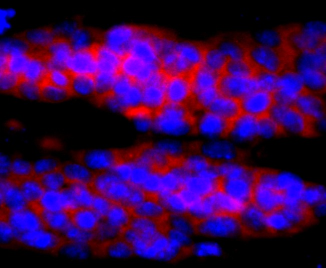 Anti-IL-4 Antibody (1H299)