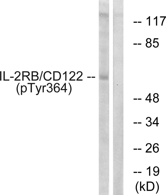 Anti-Phospho-CD122/IL2RB (Tyr364) Polyclonal Antibody