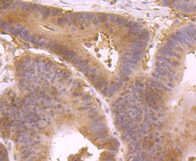 Anti-IL-4 Antibody (1H299)