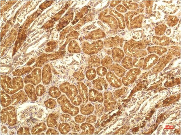 Anti-IL-8/CXCL8 Antibody (2Y592)