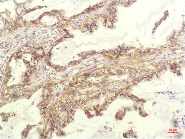Anti-IL-8/CXCL8 Antibody (2Y592)