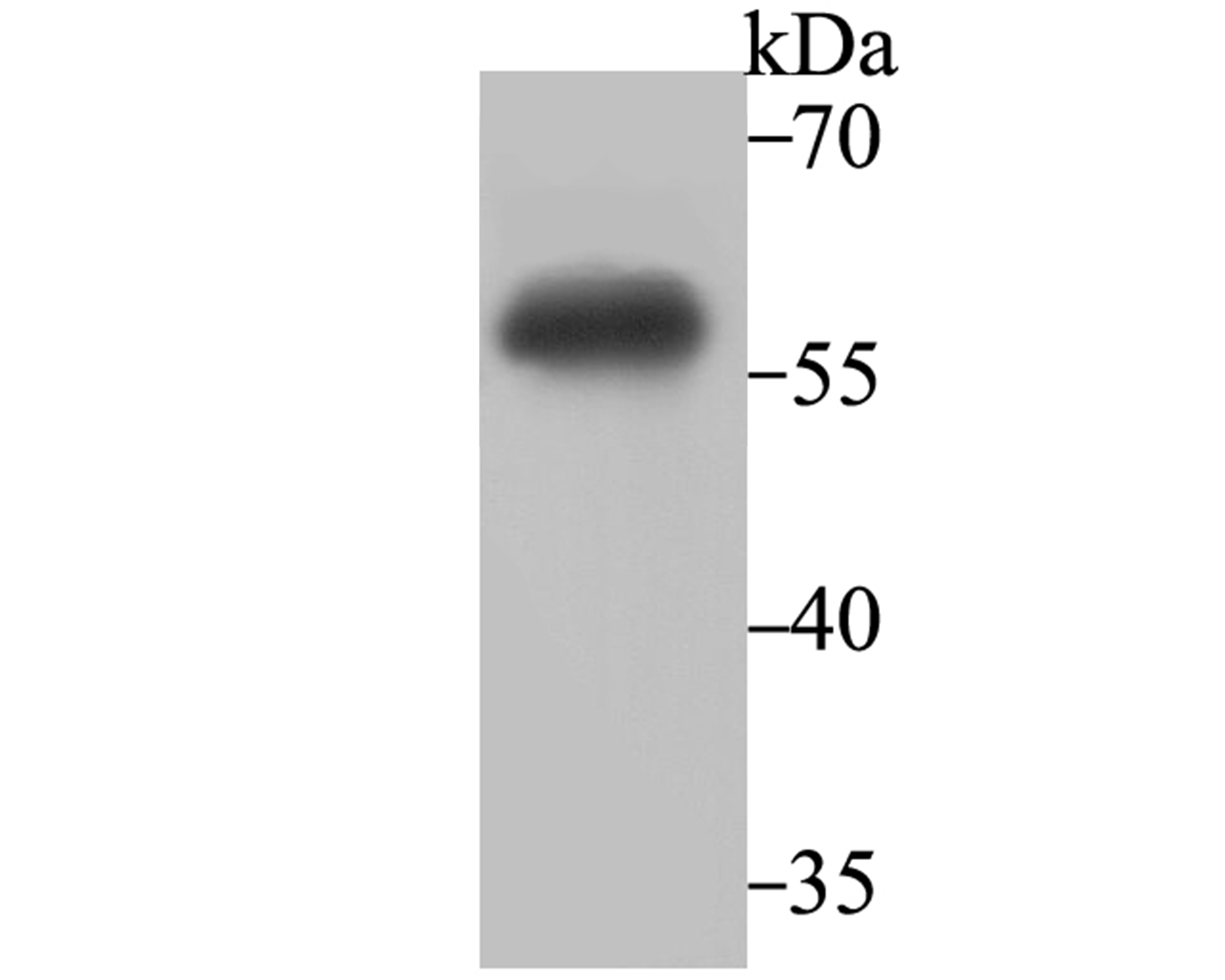 Anti-IMPDH2 Antibody (7R923)